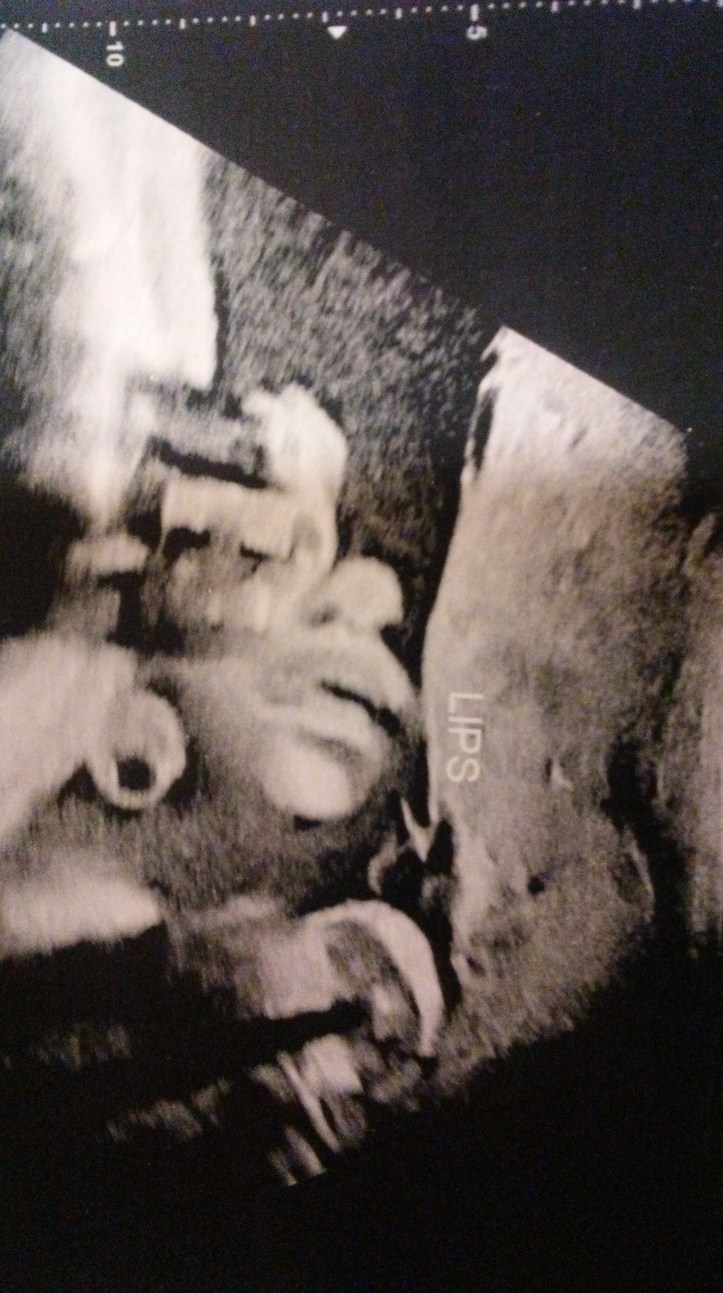 20180924_104627_Burst01